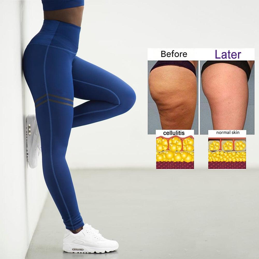 Anti-cellulitis kompressziós leggings nőknek - SculptFit