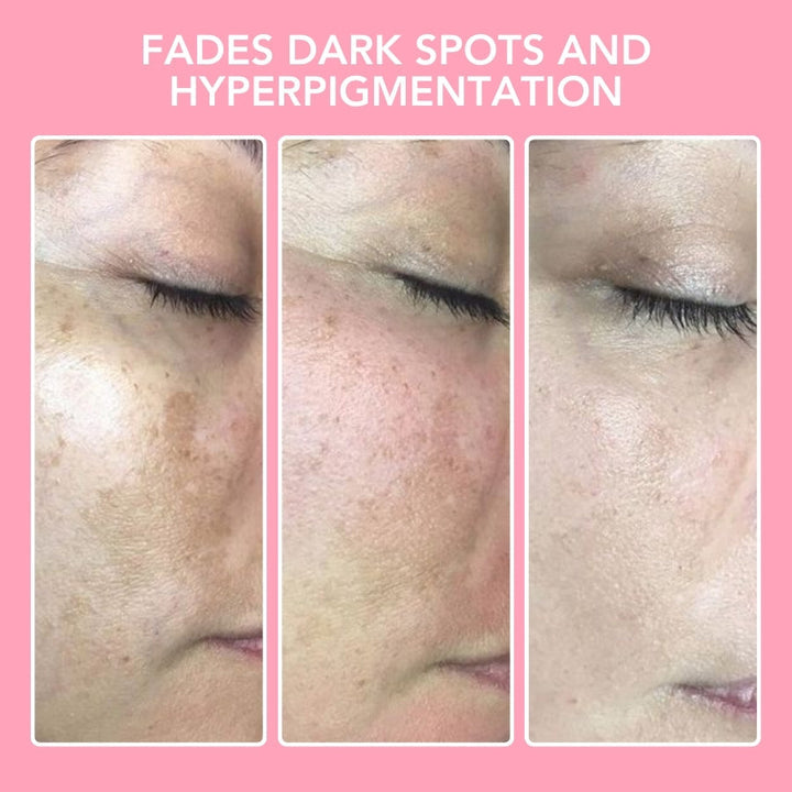 Kurkuma Kojic-sav Reinigingspadok - GlowTonic