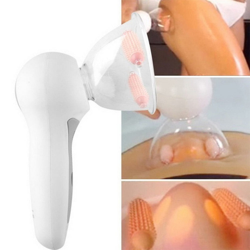 Vákuumos cellulitisz elleni masszázs készülék - SkinSculpt