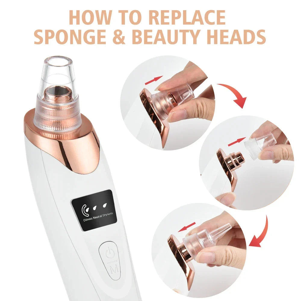 Elektromos Pattanás Eltávolító és Arcápoló - ClearSkin Pro