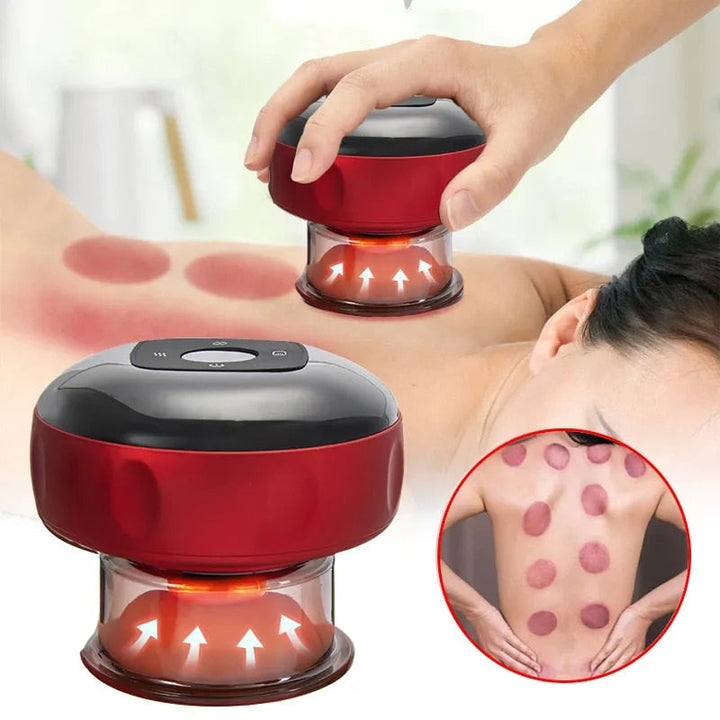 Cuppingterápia masszírozó - ThermaCupp